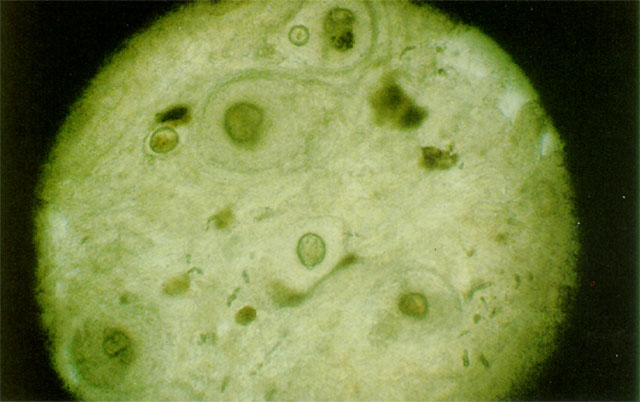 TubercD7.jpg