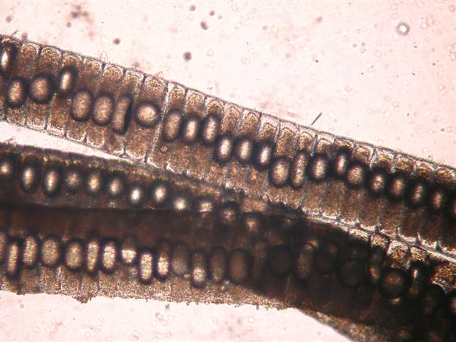 ../tools/UploadPhoto/uploads/Scjap_eggs_parasit_copepod.JPG